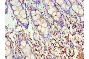Immunohistochemistry of paraffin-embedded human colon tissue using ABIN7142909 at dilution of 1:100
