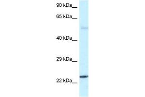 Western Blot showing RAB31 antibody used at a concentration of 1 ug/ml against Fetal Brain Lysate (RAB31 Antikörper  (C-Term))