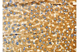 ABIN6266217 and ABIN6277375 at 1/100 staining Rat liver tissue by IHC-P.
