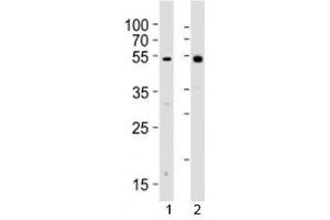 Western blot analysis of lysate from 1) human Raji cell line and 2) rat spleen tissue lysate using Lyn antibody.