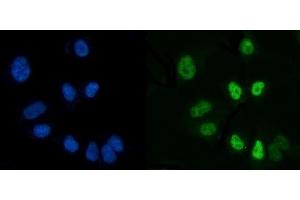 IF analysis of CTBP2 using anti-CTBP2 antibody (ABIN7601325).