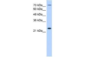 WB Suggested Anti-CLDN2 Antibody Titration:  1.