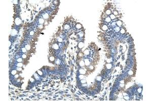 RNF121 antibody was used for immunohistochemistry at a concentration of 4-8 ug/ml to stain Epithelial cells of intestinal villus (arrows) in Human Intestine. (RNF121 Antikörper  (N-Term))