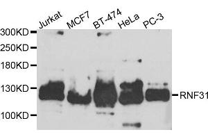 Western blot analysis of extracts of various cell lines, using RNF31 antibody. (RNF31 Antikörper)