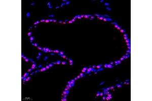 Immunofluorescence of paraffin embedded mouse bladder using PRPF4 (ABIN7075312) at dilution of 1: 500 (400x lens) (PRPF4 Antikörper)