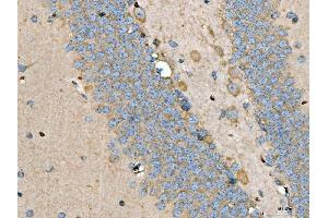IHC analysis of LARP1 using anti-LARP1 antibody (ABIN7599861). (LARP1 Antikörper  (AA 123-401))
