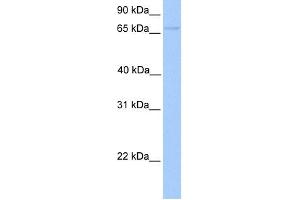 WB Suggested Anti-FOXO1 Antibody Titration:  0. (FOXO1 Antikörper  (Middle Region))