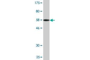 Western Blot detection against Immunogen (56. (XPO5 Antikörper  (AA 1-280))