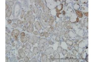Image no. 6 for anti-Oxidative-Stress Responsive 1 (OXSR1) (AA 1-528) antibody (ABIN599106) (OXSR1 Antikörper  (AA 1-528))