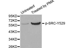 Western Blotting (WB) image for anti-Proto-oncogene tyrosine-protein kinase Src (Src) (pTyr529) antibody (ABIN1870630) (Src Antikörper  (pTyr529))