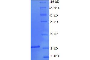 SDS-PAGE (SDS) image for Cytosol Aminopeptidase (LAP3) (AA 25-64), (partial) protein (His-SUMO Tag) (ABIN5711349) (LAP3 Protein (AA 25-64, partial) (His-SUMO Tag))