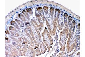 IHC analysis of MMP13 using anti-MMP13 antibody . (MMP13 Antikörper  (AA 99-335))