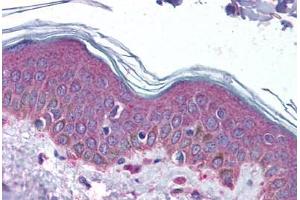 Immunohistochemistry (Paraffin-embedded Sections) (IHC (p)) image for anti-serpin Peptidase Inhibitor, Clade F (Alpha-2 Antiplasmin, Pigment Epithelium Derived Factor), Member 1 (SERPINF1) (N-Term) antibody (ABIN6739671)