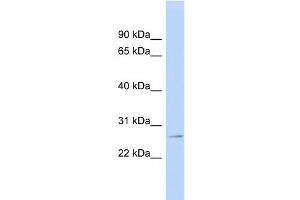 WB Suggested Anti-GSTP1 Antibody Titration:  0. (GSTP1 Antikörper  (N-Term))