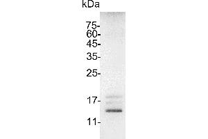 SDS-PAGE (SDS) image for Interleukin 15 (IL15) (Active) protein (His tag) (ABIN7884449)