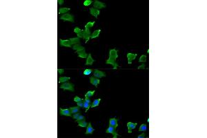 Immunofluorescence analysis of MCF-7 cells using GLUL antibody. (GLUL Antikörper)