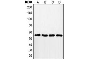 Western blot analysis of RAD18 expression in MCF7 (A), A549 (B), Jurkat (C), HCT116 (D) whole cell lysates. (RAD18 Antikörper  (Center))