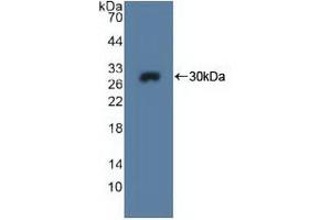 Detection of Recombinant MPG, Human using Polyclonal Antibody to N-Methylpurine DNA Glycosylase (MPG) (MPG Antikörper  (AA 221-296))