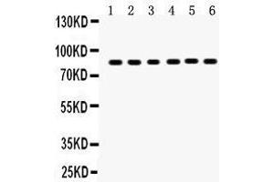 Anti-TPA Picoband antibody, Western blotting All lanes: Anti TPA  at 0. (PLAT Antikörper  (AA 366-562))