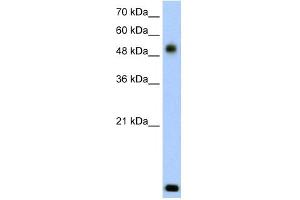 WB Suggested Anti-RSAD2 Antibody Titration:  2. (RSAD2 Antikörper  (N-Term))