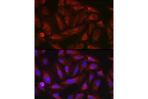 Immunofluorescence analysis of U-2 OS cells using ErbB4/HER4 Rabbit pAb (ABIN6131263, ABIN6140257, ABIN6140260 and ABIN6221732) at dilution of 1:100 (40x lens). (ERBB4 Antikörper  (AA 26-160))