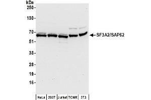 anti-Splicing Factor 3a, Subunit 2, 66kDa (SF3A2) (AA 1-50) antibody