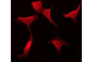 ABIN6275423 staining Hela by IF/ICC. (PLEKHG4 Antikörper  (Internal Region))