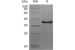 Western Blotting (WB) image for Fibrinogen-Like 1 (FGL1) (Active) protein (His tag,Biotin) (ABIN7319771)