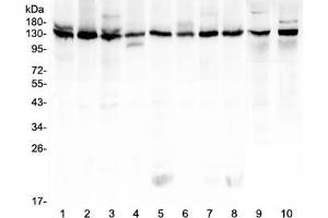 Western blot testing of human 1) K562, 2) HeLa, 3) 293T, 4) A431, 5) Caco-2, 6) PC-3, 7) MCF7, 8) U-2 OS, 9) rat testis and 10) mouse testis lysate with Bub1 antibody at 0. (BUB1 Antikörper  (AA 731-1085))