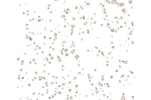 Immunocytochemistry (ICC) image for anti-Ectonucleoside Triphosphate diphosphohydrolase 1 (ENTPD1) (AA 300-350) antibody (ABIN7795686)