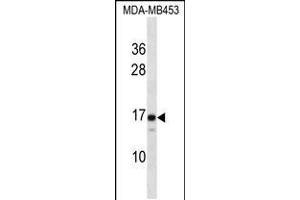 Western blot analysis in MDA-MB453 cell line lysates (35ug/lane). (LIM2 Antikörper  (C-Term))