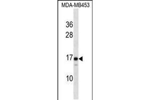 Western Blotting (WB) image for anti-Lens Intrinsic Membrane Protein 2, 19kDa (LIM2) (AA 110-137), (C-Term) antibody (ABIN5536537)
