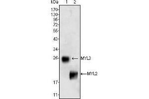 Western blot analysis using MYL3 (1) and MYL2 (2) mouse mAb against rat fetal heart tissues lysate. (MYL3/CMLC1 Antikörper)