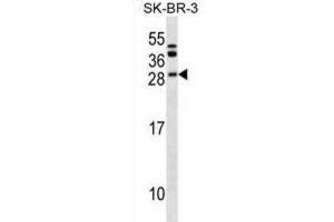 Western Blotting (WB) image for anti-B-Cell CLL/lymphoma 7C (BCL7C) antibody (ABIN2999905) (BCL7C Antikörper)