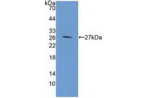 Detection of Recombinant GP39, Mouse using Polyclonal Antibody to Chitinase-3-like Protein 1 (CHI3L1) (CHI3L1 Antikörper  (AA 112-356))