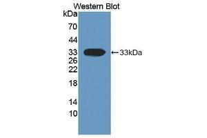 Western Blotting (WB) image for anti-Dickkopf Homolog 1 (DKK1) (AA 33-266) antibody (ABIN3201490) (DKK1 Antikörper  (AA 33-266))