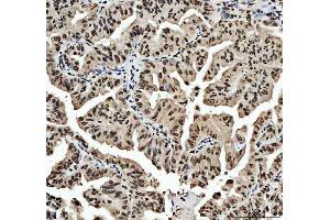 IHC analysis of HNRNPL using anti-HNRNPL antibody (ABIN4886624). (HNRNPL Antikörper  (C-Term))
