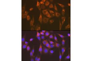 Immunofluorescence analysis of NIH-3T3 cells using Sec23AA Rabbit mAb (ABIN7270168) at dilution of 1:100 (40x lens). (SEC23A Antikörper)