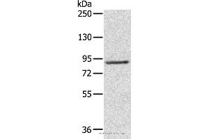 Western blot analysis of 231 cell, using RPS6KA1 Polyclonal Antibody at dilution of 1:800 (RPS6KA1 Antikörper)
