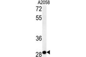 Western Blotting (WB) image for anti-Chromosome 11 Open Reading Frame 46 (C11orf46) antibody (ABIN2995509)