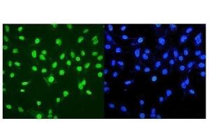 IF analysis of MTA2 using anti-MTA2 antibody (ABIN7599519).
