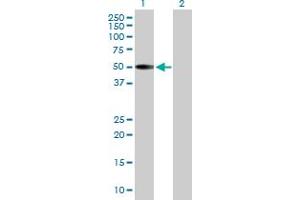 Western Blot analysis of KRT36 expression in transfected 293T cell line by KRT36 MaxPab polyclonal antibody. (Keratin 36 Antikörper  (AA 1-417))