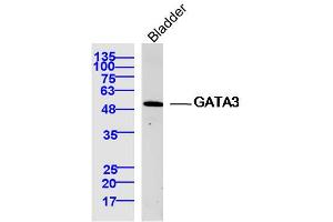 Mouse bladder lysates probed with GATA3 Polyclonal Antibody, Unconjugated  at 1:300 dilution and 4˚C overnight incubation. (GATA3 Antikörper  (AA 151-250))