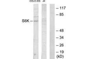 Western blot analysis of extracts from COLO205/Jurkat cells, using S6K Antibody. (RPS6KB1 Antikörper  (AA 261-310))