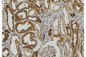 Immunohistochemistry (IHC) image for anti-ADAM Metallopeptidase with Thrombospondin Type 1 Motif, 1 (ADAMTS1) (Internal Region) antibody (ABIN6259779)