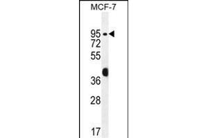 RACG Antibody (N-term) 1461a western blot analysis in MCF-7 cell line lysates (35 μg/lane).
