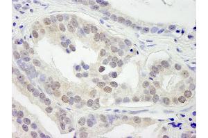 Immunohistochemistry (IHC) image for anti-Lysine (K)-Specific Demethylase 3B (KDM3B) (C-Term) antibody (ABIN7448615)