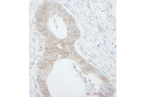 Immunohistochemistry (IHC) image for anti-Eukaryotic Translation Initiation Factor 4E Binding Protein 1 (EIF4EBP1) (C-Term) antibody (ABIN7448395)