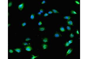 Immunofluorescent analysis of U251 cells using ABIN7148217 at dilution of 1:100 and Alexa Fluor 488-congugated AffiniPure Goat Anti-Rabbit IgG(H+L) (COL8A1 Antikörper  (AA 572-744))