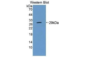 Detection of Recombinant EMR1, Human using Polyclonal Antibody to EGF Like Module Containing Mucin Like Hormone Receptor 1 (EMR1) (F4/80 Antikörper  (AA 1-201))